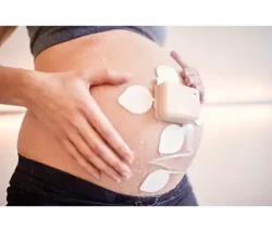 Philips Avalon beltless fetal monitoring solution Cableless fetal and maternal pod with adhesive patch