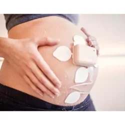 Philips Avalon beltless fetal monitoring solution Cableless fetal and maternal pod with adhesive patch